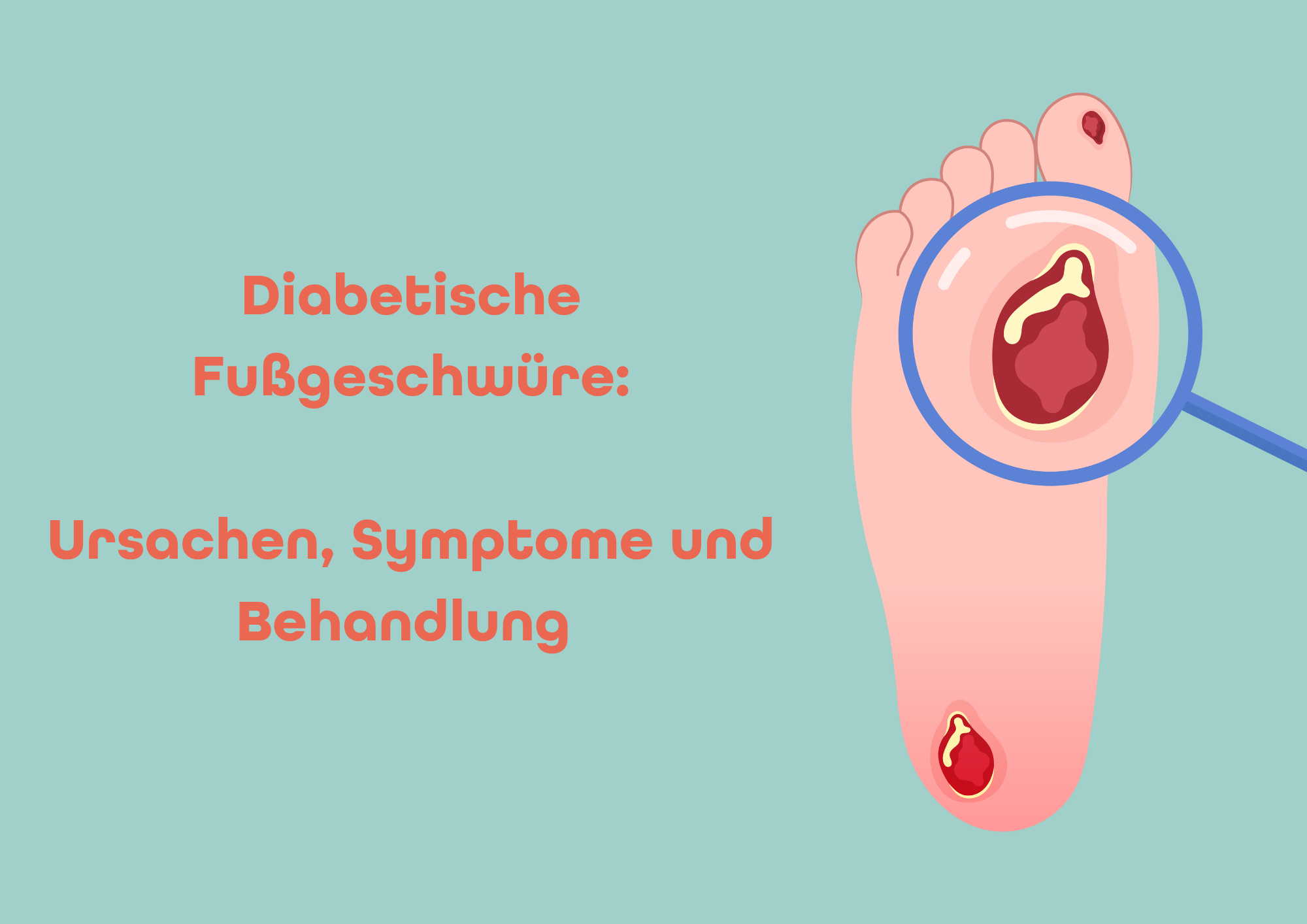 Diabetische Fußgeschwüre – Ursachen, Symptome und Behandlung – osentec